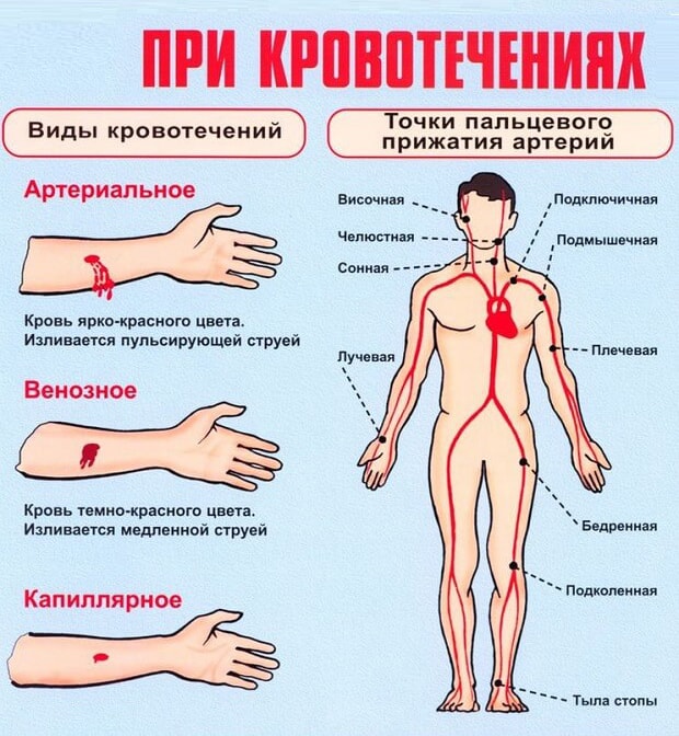 Как остановить кровь