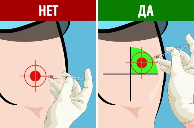Как делать укол в ягoдицу - Самая подробная инструкция