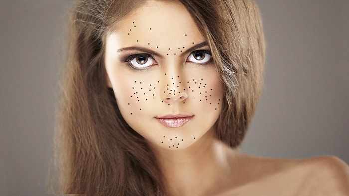 Как избавиться от черных точек